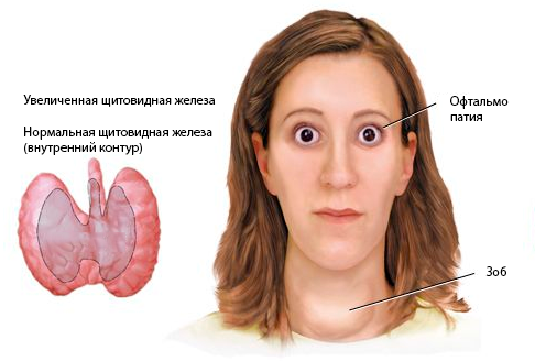 Резекция лимфатических узлов